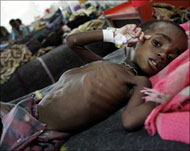 صورة أرشيفية من عام 2005 لطفل من ملاوي مصاب بسوء التغذية (رويترز)