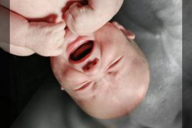 الرضع البكائين