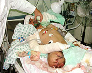 فلسطيني يتلقى العلاج بعد تعرضه لشظايا صاروخ إسرائيلي  (الجزيرة نت)