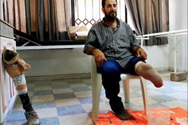 f_Ali Wansa (L), a 44-year-old Lebanese national who lost his leg in an Israeli cluster bomb, waits for a physical therapist to check his amputated leg at the Hezbollah run al