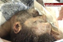 جثة شاكر العبسي زعيم جماعة فتح الإسلام في المستشفى الحكومي في طرابلس شمال لبنان