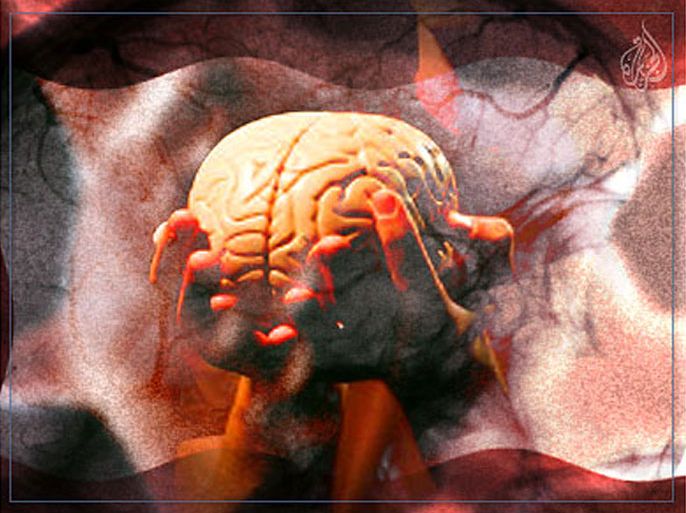 أمراض المخ - فقدان الذاكرة - الدماغ
