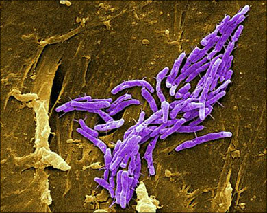 صورة مجهرية لبكتيريا السل في إحدى خلايا الرئة