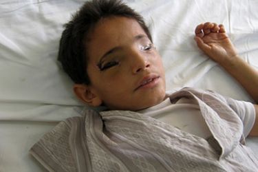 1- سليم الحرازي : طفل يمني فقد عينية برصاص قناصة (الجزيرة نت )
