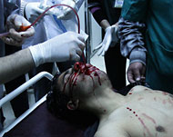 أحد المصابين أثناء اقتحام الأمن الجامع العمري بدرعا (الفرنسية)