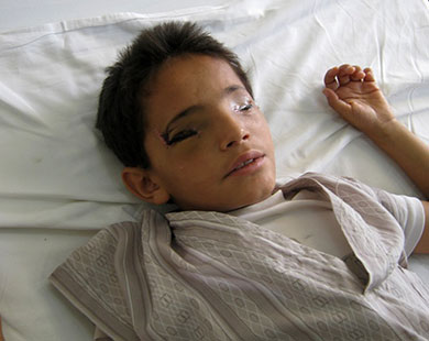  طفل يمني فقد عينيه برصاص قناصة (الجزيرة نت) 