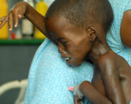 الأطفال من أكثر الفئات المتضررة من الجفاف (الفرنسية) 