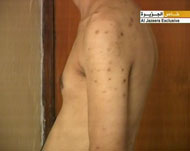 مكتب المالكي وعد بإصلاحات بعد كشف سجن فيه معتقلون تعرضوا للتعذيب العام الماضي (الجزيرة)