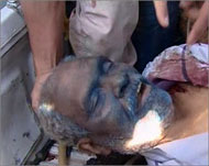 صورة جثة وزير دفاع القذافي أبو بكر يونس (الجزيرة)