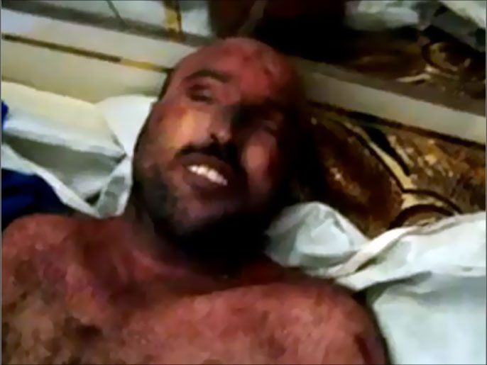 صورة بثت على موقع يوتيوب لأحد ضحايا التعذيب في سوريا(الجزيرة)