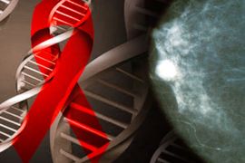 الحمض النووي والجينات مؤشرات مبكرة لسرطان الثدي والمبيض