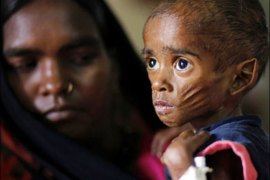 r : Ranbir, 26 months, who weighs 5 kg and suffers from severe malnutrition, is seen with his mother Munni in the Nutritional Rehabilitation Centre of Shivpuri district in the central Indian state of Madhya Pradesh April 7, 2010. India ranked 65th out of 84 countries in the Global Hunger Index of 2009, below countries including North Korea and Zimbabwe -- hindering India's ambitions to channel its demographic dividend to fuel its global economic ambitions. Picture taken April 7, 2010. To match feature INDIA-WELFARE/ REUTERS/Reinhard Krause (INDIA - Tags: BUSINESS FOOD HEALTH IMAGES OF THE DAY SOCIETY)