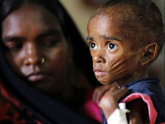 r : Ranbir, 26 months, who weighs 5 kg and suffers from severe malnutrition, is seen with his mother Munni in the Nutritional Rehabilitation Centre of Shivpuri district in the central Indian state of Madhya Pradesh April 7, 2010. India ranked 65th out of 84 countries in the Global Hunger Index of 2009, below countries including North Korea and Zimbabwe -- hindering India's ambitions to channel its demographic dividend to fuel its global economic ambitions. Picture taken April 7, 2010. To match feature INDIA-WELFARE/ REUTERS/Reinhard Krause (INDIA - Tags: BUSINESS FOOD HEALTH IMAGES OF THE DAY SOCIETY)