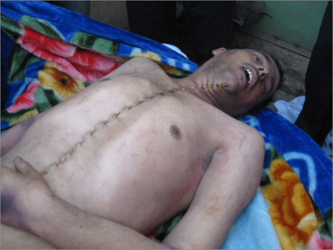 اتهامات للسلطات العراقية بتعذيب للسجناء يفضي أحيانا للموت (الجزيرة)