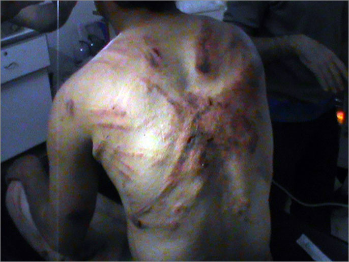 ‪سوري تعرض للتعذيب من قبل قوات النظام بحمص‬ سوري تعرض للتعذيب من قبل قوات النظام بحمص (الفرنسية-أرشيف)