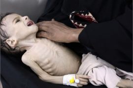 A woman holds her malnourished child at a therapeutic feeding center at al-Sabyeen hospital in Sanaa May 28, 2012. REUTERS/Mohamed al-Sayaghi (YEMEN - Tags: SOCIETY POVERTY TPX IMAGES OF THE DAY HEALTH)