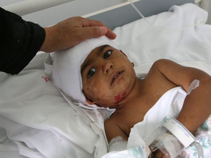 ‪طفل لبناني جرح في قصف السبت‬  (الفرنسية)