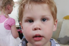 صورة من صحيفة ديلي تلغراف - دراسة لمعرفة سبب العين الكسولة عند الطفل الأحول