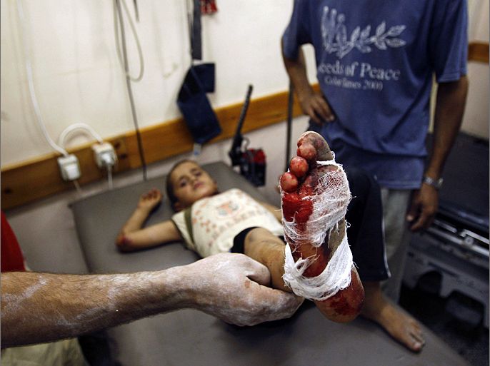 A man shows the leg of a wounded Palestinian boy in a hospital following an Israeli air strike in Rafah camp in the southern Gaza Strip October 7, 2012. A missile fired by an Israeli aircraft hit and wounded two Palestinian militants and eight bystanders in the southern Gaza Strip on Sunday, Palestinian hospital officials said. REUTERS/Ahmed Zakot (GAZA - Tags: POLITICS CIVIL UNREST)