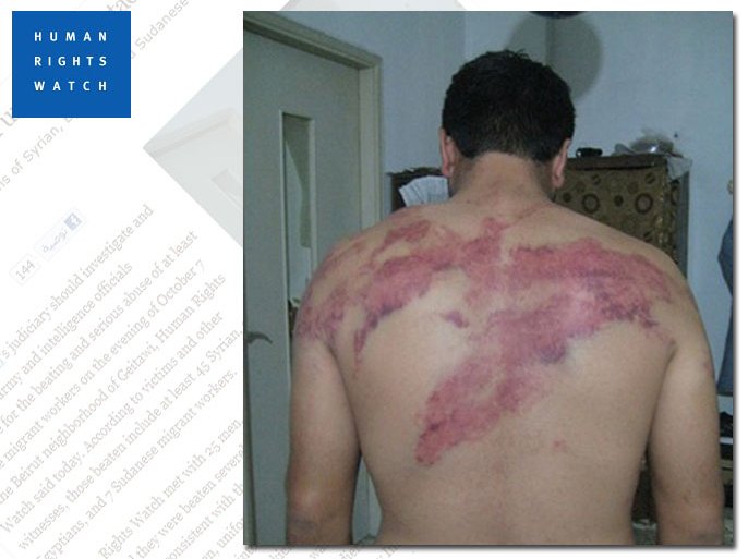 صورة نشرتها هيومان رايتس ووتش لحدث تعذيب احد العمال المهاجرين من قبل القوات اللبنانية