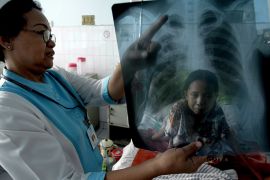 epa00675957 An Indonesian nurse shows a x-ray film to Arni as she gets tuberculosis medical treatments at a hospital in Jakarta, Indonesian on Friday 24 March 2006. The government is determined to halve the daily deaths from tuberculosis to 150 from an estimated 300 by the year 2015. Indonesia has the third highest number of tuberculosis cases after India and China, with some 600,000 patients currently across the sprawling archipelago nation. EPA/BAGUS INDAHONO