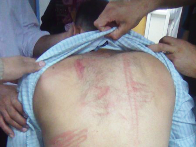 ‪تقرير الهيئة رصد 306 ادعاءات بالتعذيب خلال العام 2012‬ (الجزيرة نت)
