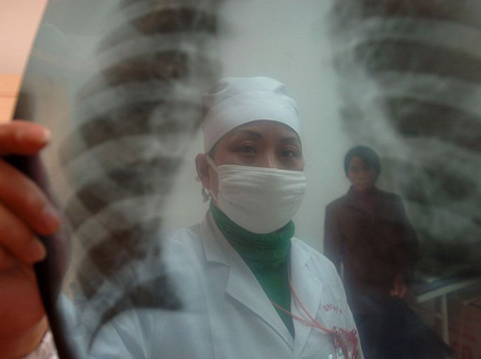 epa00675165 A doctor reads an X-ray photo of lungs at the Center of Diseases Control and Prevention in Hefei in east China's Anhui province, Thursday, 23 March 2006. Friday will be the 11th World Tuberculosis Day. Tuberculosis is the number one epidemic in Anhui province. EPA/SHOU SHENG