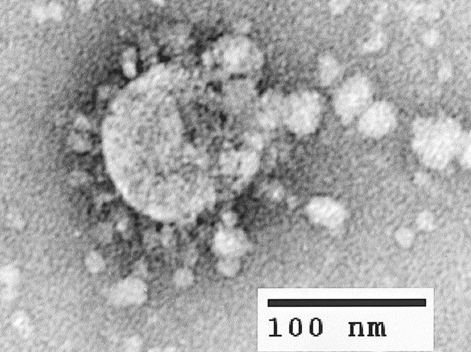 FILES) CDC Handout picture dated April 2003 shows a Coronavirus under a microscope. Coronaviruses are a group of viruses that have a halo or crown-like (corona) appearance when viewed under a microscope. US Centers for Disease Control (CDC) scientists were able to isolate a virus from the tissues of two patients who had SARS and then used several laboratory methods to characterize the agent. Examination by electron microscopy revealed that the virus had the distinctive shape and appearance of coronaviruses. B/W ONLY EPA PHOTO EPA / CDC