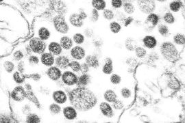 CDC Handout picture dated April 2003 shows a Coronavirus under a microscope. Coronaviruses are a group of viruses that have a halo or crown-like (corona) appearance when viewed under a microscope. US Centers for Disease Control (CDC) scientists were able to isolate a virus from the tissues of two patients who had SARS and then used several laboratory methods to characterize the agent. Examination by electron microscopy revealed that the virus had the distinctive shape and appearance of coronaviruses. B/W ONLY EPA PHOTO EPA / CDC
