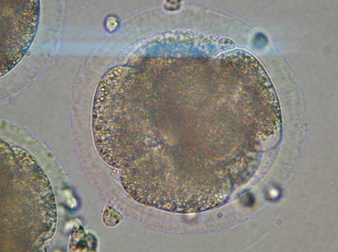 This undated photo released by Clonaid reportedly shows a human embryo resulting from human DNA nucleus transfer technology. A human baby was born 26 December 2002 through cloning the first on record French scientist and member of the Raelian cult Brigitte Boisseleir said. The baby girl was born by caesarian section and the birth went very well Boisselier president of the human cloning society Clonaid said. EPA PHOTO / CLONAID