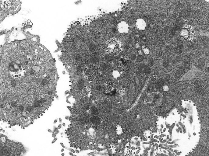 (FILES) CDC Handout picture dated April 2003 shows a Coronavirus under a microscope. Coronaviruses are a group of viruses that have a halo or crown-like (corona) appearance when viewed under a microscope. US Centers for Disease Control (CDC) scientists were able to isolate a virus from the tissues of two patients who had SARS and then used several laboratory methods to characterize the agent. Examination by electron microscopy revealed that the virus had the distinctive shape and appearance of coronaviruses. B/W ONLY EPA PHOTO EPA / CDC