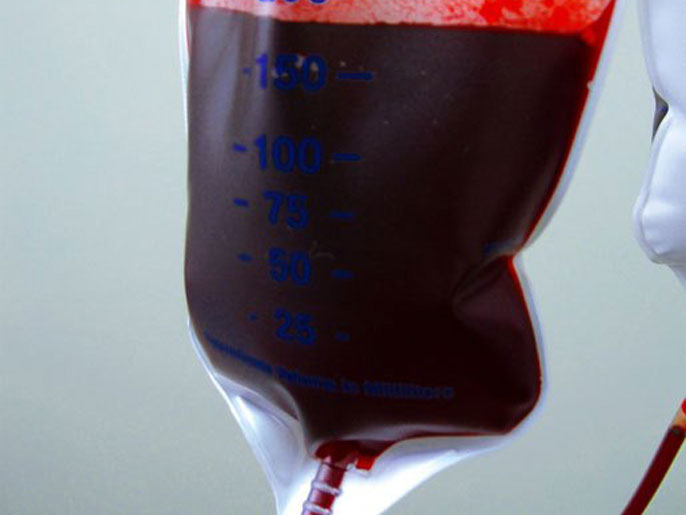 ‪(دريمز تايم)‬ الدم كان من وسائل انتقال الإيدز قبل بدء فحوصات نقل الدم عام 1985 للتأكد من خلوه من الفيروس 