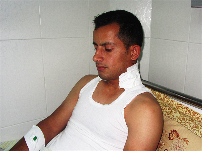 ‪‬ محمد العملة أصيب بجروح في رقبته بعضة كلب أطلقه الاحتلال عليه(الجزيرة)