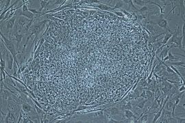 A photo provided by the Oregon Health & Science University shows a stem cell colony produced from human skin cells. Scientists at the university and the Oregon National Primate Research Center (ONPRC) have successfully reprogrammed human skin cells to become embryonic stem cells capable of transforming into any other cell type in the body. The research was led by Shoukhrat Mitalipov and follows the 2007 success in transforming monkey skin cells into embryonic stem cells.