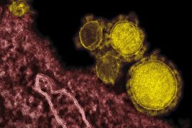 This undated electron microscope image made availalbe by the National Institute of Allergy and Infections Diseases - Rocky Mountain Laboratories shows novel coronavirus particles, also known as the MERS virus, colorized in yellow. The mysterious new respiratory virus that originated in the Middle East spreads easily between people and appears more deadly than SARS, doctors reported Wednesday, June 19, 2013 after investigating the biggest outbreak in Saudi Arabia.