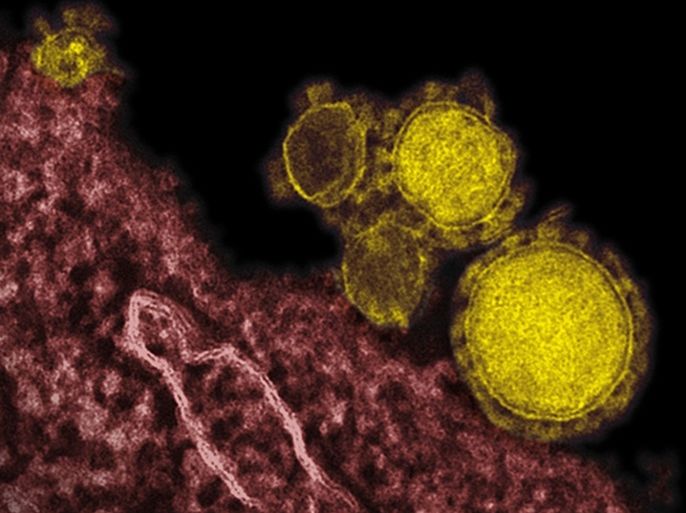 This undated electron microscope image made availalbe by the National Institute of Allergy and Infections Diseases - Rocky Mountain Laboratories shows novel coronavirus particles, also known as the MERS virus, colorized in yellow. The mysterious new respiratory virus that originated in the Middle East spreads easily between people and appears more deadly than SARS, doctors reported Wednesday, June 19, 2013 after investigating the biggest outbreak in Saudi Arabia.