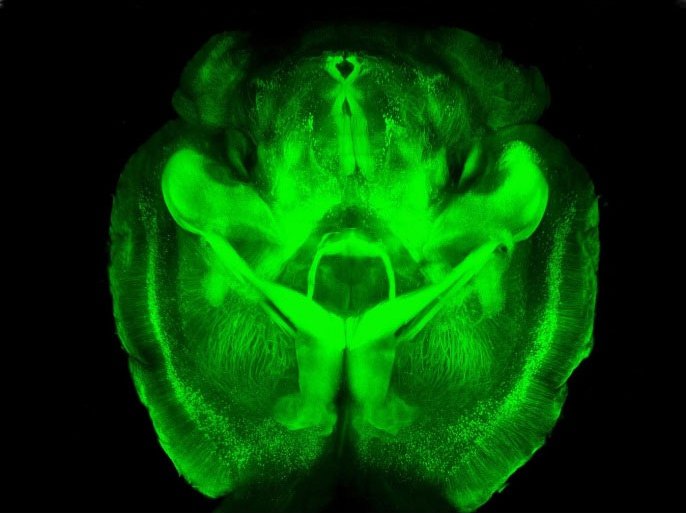This undated image provided by Karl Deisseroth's lab shows a three-dimensional rendering of clarified mouse brain seen from below. Scientists have made mouse brains transparent, permitting a comprehensive and exquisitely detailed view of their inner structures, providing a major new tool for research."You get the big picture without losing track of the details,'' said Dr. Karl Deisseroth, who led the Stanford team that reported the work online Wednesday, April 10, 2013 in the journal Nature. Some other labs are already working to apply the technique on other kinds of tissue, such as for studying breast cancer biopsies, Deisseroth said.