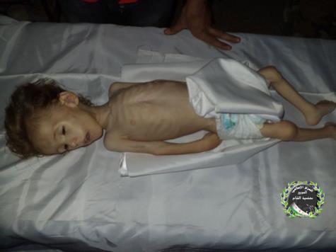 أحد الأطفال الذين توفوا بسبب نقص الغذاء (نقلا عن ناشطين عبر فيسبوك) 