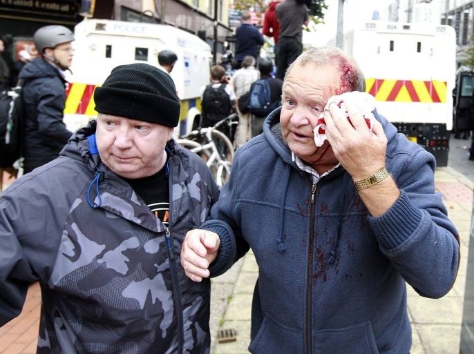 A man covers a wound to his head after loyalist protesters attacked the police with bricks and bottles as they waited for a republican parade to make its way through Belfast City Centre, August 9, 2013. Police fired plastic bullets and water cannon at rioters in the heart of Belfast on Friday after being pelted by missiles for the second successive night in the latest bout of Northern Ireland's sporadic sectarian violence. Police said two officers were injured. Eight were hurt the previous night when a crowd threw paint bombs, bottles and masonry at police.