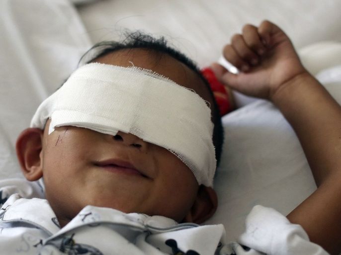 Six-year-old boy Binbin, whose eyes were gouged out, lies on a hospital bed in Taiyuan, Shanxi province, August 29, 2013. Chinese police are hunting for a woman suspected of gouging out the eyes of the six-year-old boy, possibly to get her hands on his corneas to sell on the organ transplant black market, state media reported on Wednesday, a crime which has horrified China. Police are offering a reward of 100,000 yuan ($16,300) for the capture of the woman suspected of the crime. Picture taken August 29, 2013.