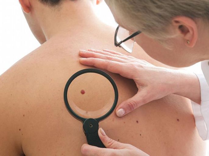 تحديد خصائص الجينات جيدا يساعد في تحديد الأدوية الخاصة بعلاج سرطان الجلد مثلا