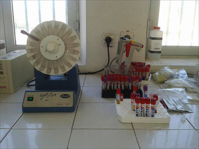 ‪معدات فحص مرض الإيدز في مركز يونس توسان‬  (الجزيرة)