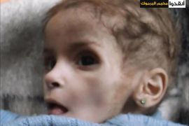 طفلة تموت جوعا بمخيم اليرموك المحاصر