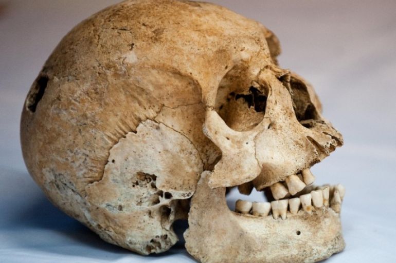 View of a skull of pre-Hispanic indigenous man at the Pre-Hispanic Ossuarty in Cali, Colombia, on September 30, 2013. The ossuary preserves some 250 bone collections and 220 dental collections of the Sonso, Late Quimbaya, Bolo-Quebrada Seca, Piartal and Tuza cultures, which inhabited the southwest of Colombia between 500 and 1500 AD. AFP PHOTO / LUIS ROBAYO