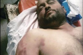 اسم الضحية محمد عيسى الجبالي ( 41) توفى تحت التعذيب كما تقول عائلته