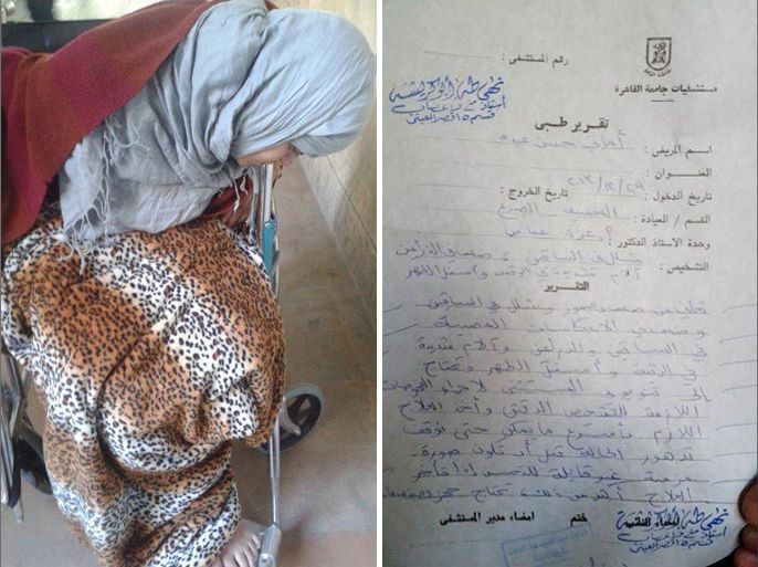 أم مصرية عذبت حتى الشلل التام على يد قوات الأمن