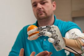 This March 2013 handout photo provided by Science Translational Medicine shows amputee Dennis Aabo Sørensen holding an orange while wearing sensory feedback enabled prosthesis in Rome. To feel what you touch _ that's the holy grail for artificial limbs. In a step toward that goal, European researchers created a robotic hand that let an amputee feel differences between a bottle, a baseball and a mandarin orange. (AP Photo/Patrizia Tocci, Science Translational Medicine)