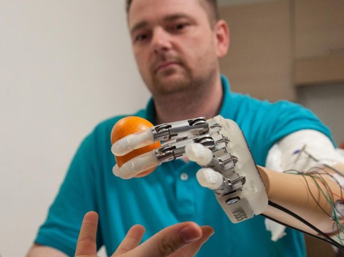 This March 2013 handout photo provided by Science Translational Medicine shows amputee Dennis Aabo Sørensen holding an orange while wearing sensory feedback enabled prosthesis in Rome. To feel what you touch _ that's the holy grail for artificial limbs. In a step toward that goal, European researchers created a robotic hand that let an amputee feel differences between a bottle, a baseball and a mandarin orange. (AP Photo/Patrizia Tocci, Science Translational Medicine)