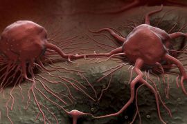 برمجة فيروس الحصبة لتفجير الخلايا السرطانية