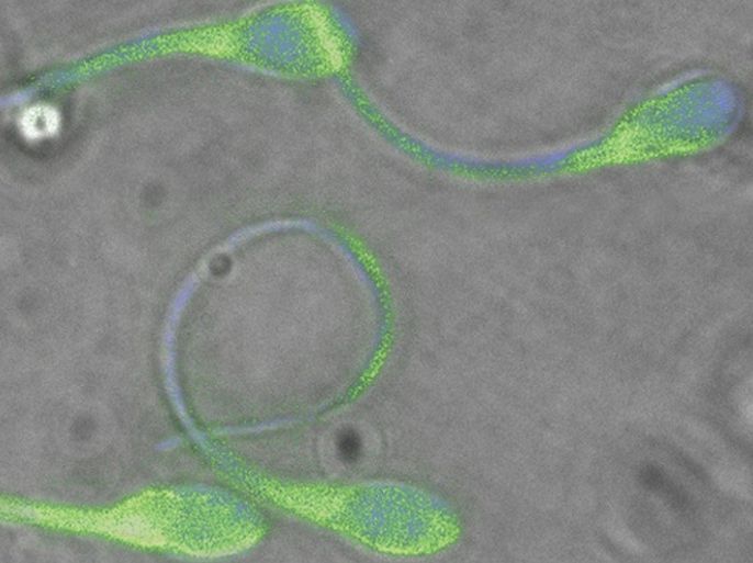 An undated electron microscope image shows sperm from human donors that posses only the mutated DEFB126 gene have a significantly reduced quantity of negatively charged sugars (green fluorescence) on their surface. Sperm that lack DEFB126, or the negatively charges sugars associated with the DEFB126 protein, have difficulty swimming though mucosal fluids of the female reproductive system. A genetic mutation that removes a coating of carbohydrates around sperm reduces their mobility and may explain why some men are less fertile than others, researchers said on July 21, 2011. The study, published in the journal Science Translational Medicine, found that couples who had the most trouble conceiving were those where the men inherited both copies of this mutant gene, one from their father and one from their mother.